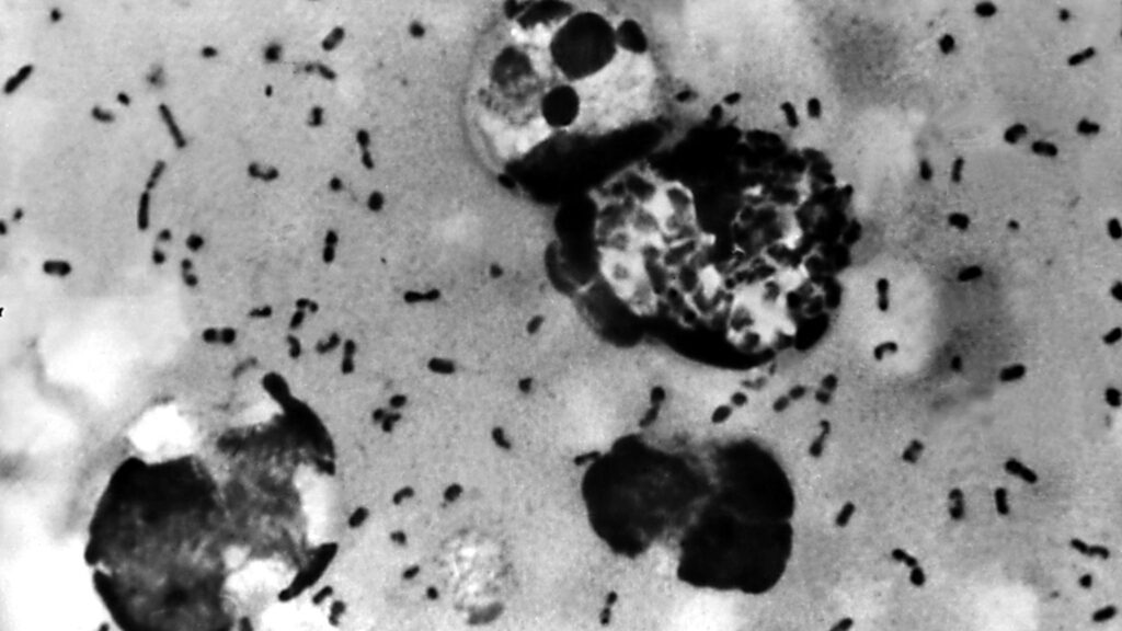 Microscopia mostrando a bactéria Yersinia pestis, conhecida por causar surtos de peste ao longo da história.
