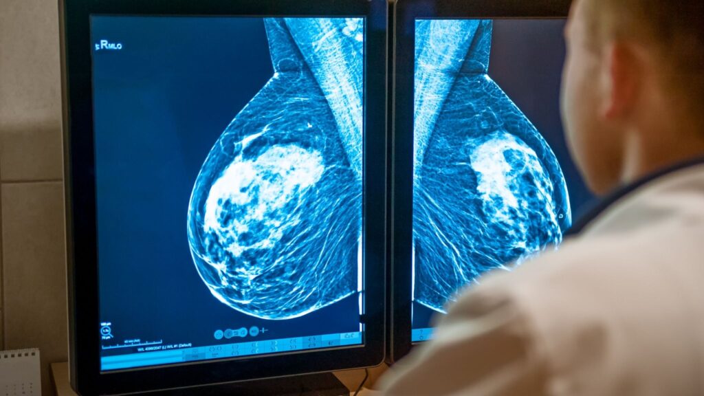Mulheres saudáveis acima de 80 podem se beneficiar do exame. (Foto: Oksana Krasiuk / Canva Pro)
