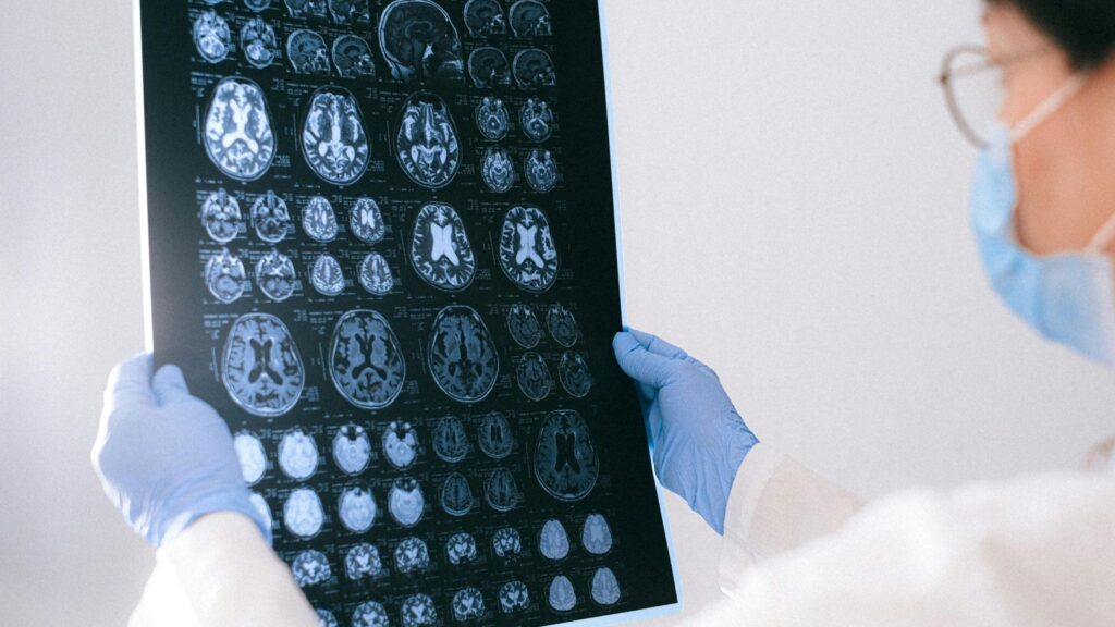 Quatro trajetórias aumentam o risco de Alzheimer. (Foto: Pexels / Canva Pro)