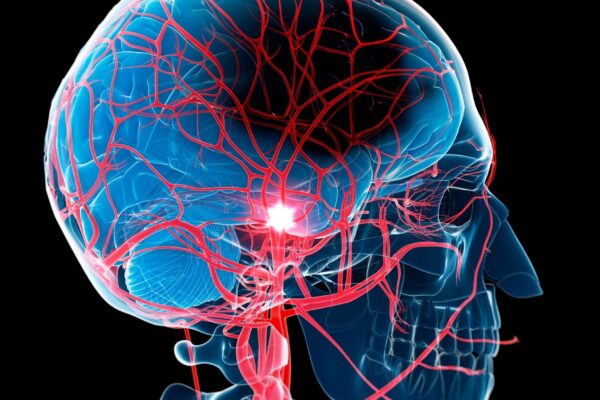 Prevenir o AVC é cuidar do coração e do cérebro. (Foto: Photo Library via Canva)