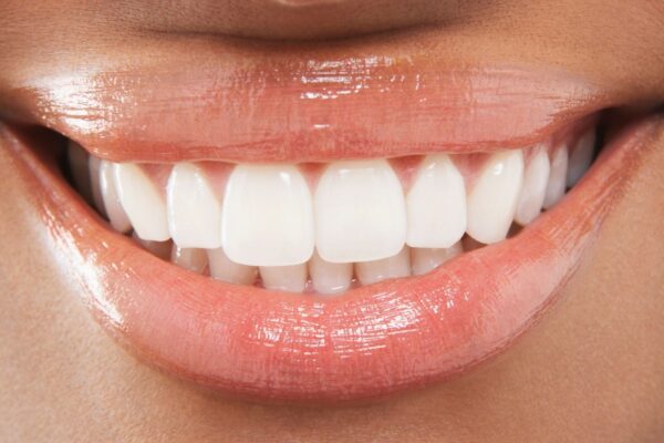 DNA gigante em bactérias pode afetar imunidade. (Foto: DAPA Images via Canva)