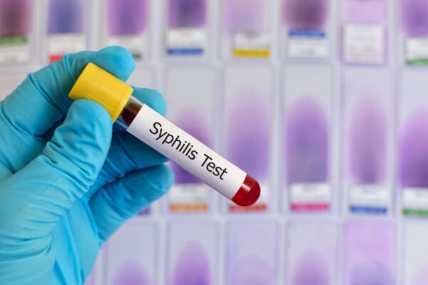 Adultos acima de 40 anos registram aumento de infecções. (Foto: Getty Images via Canva)