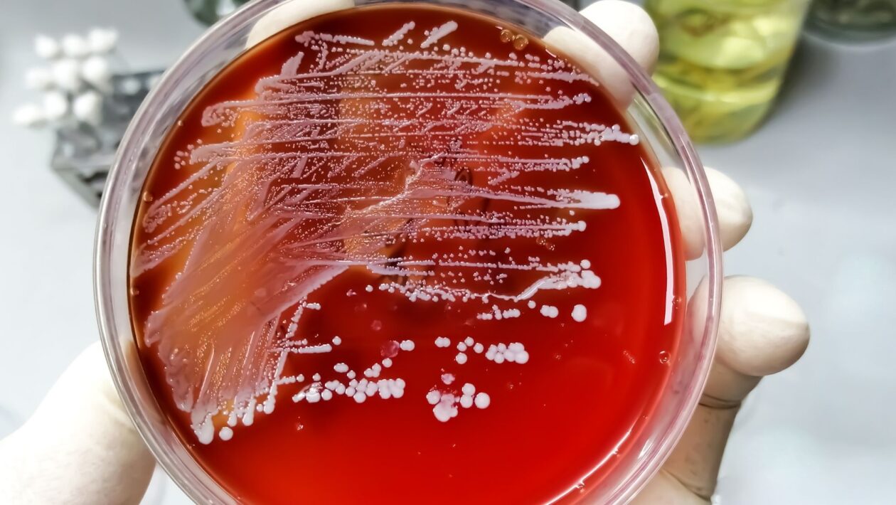 Staphylococcus aureus pode causar fasciíte necrosante. (Foto: Getty Images via Canva)