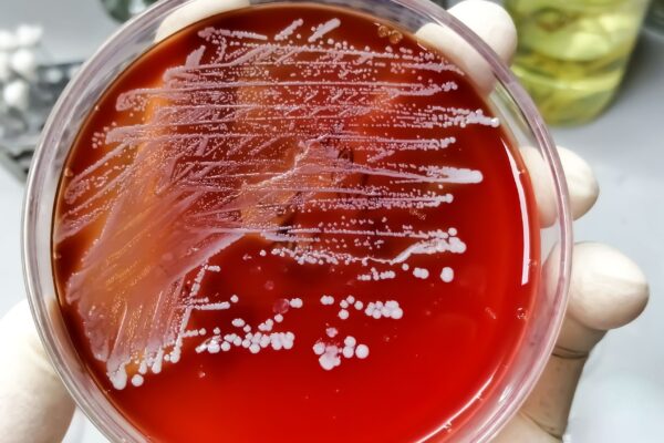 Staphylococcus aureus pode causar fasciíte necrosante. (Foto: Getty Images via Canva)
