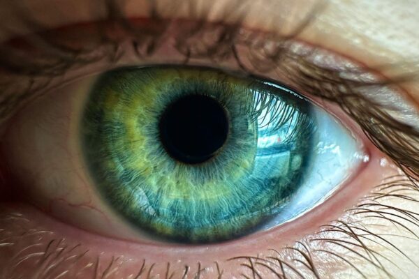 Microchip sob a retina devolve visão a pacientes cegos. (Foto: Pexels via Canva)