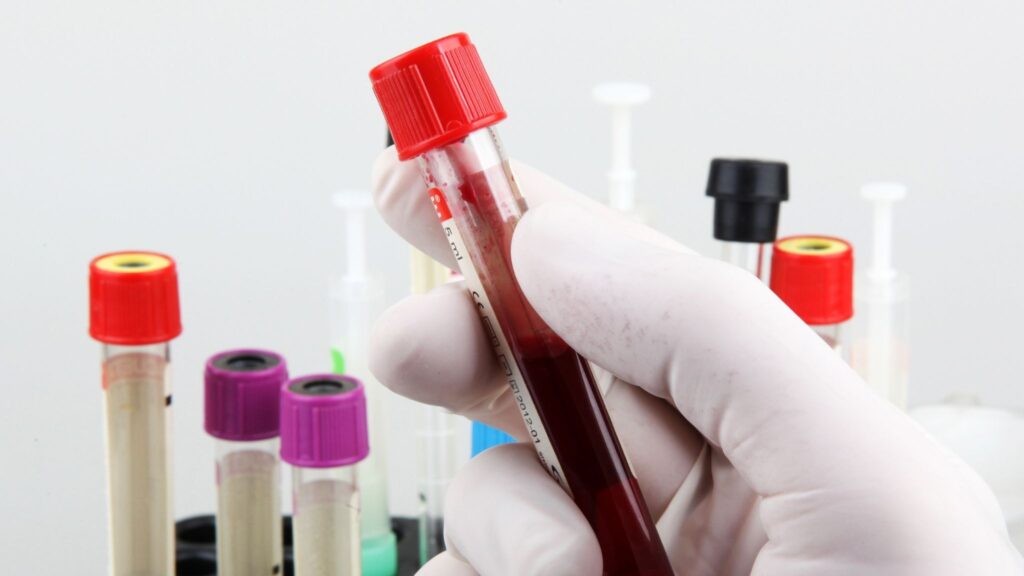 Teste nacional pode ampliar acesso ao diagnóstico no SUS. (Foto: Nenov Brothers via Canva)