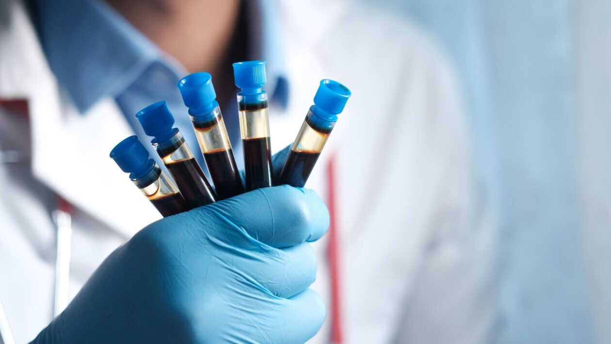 Exame de sangue detecta Alzheimer com alta precisão. (Foto: Pexels via Canva)