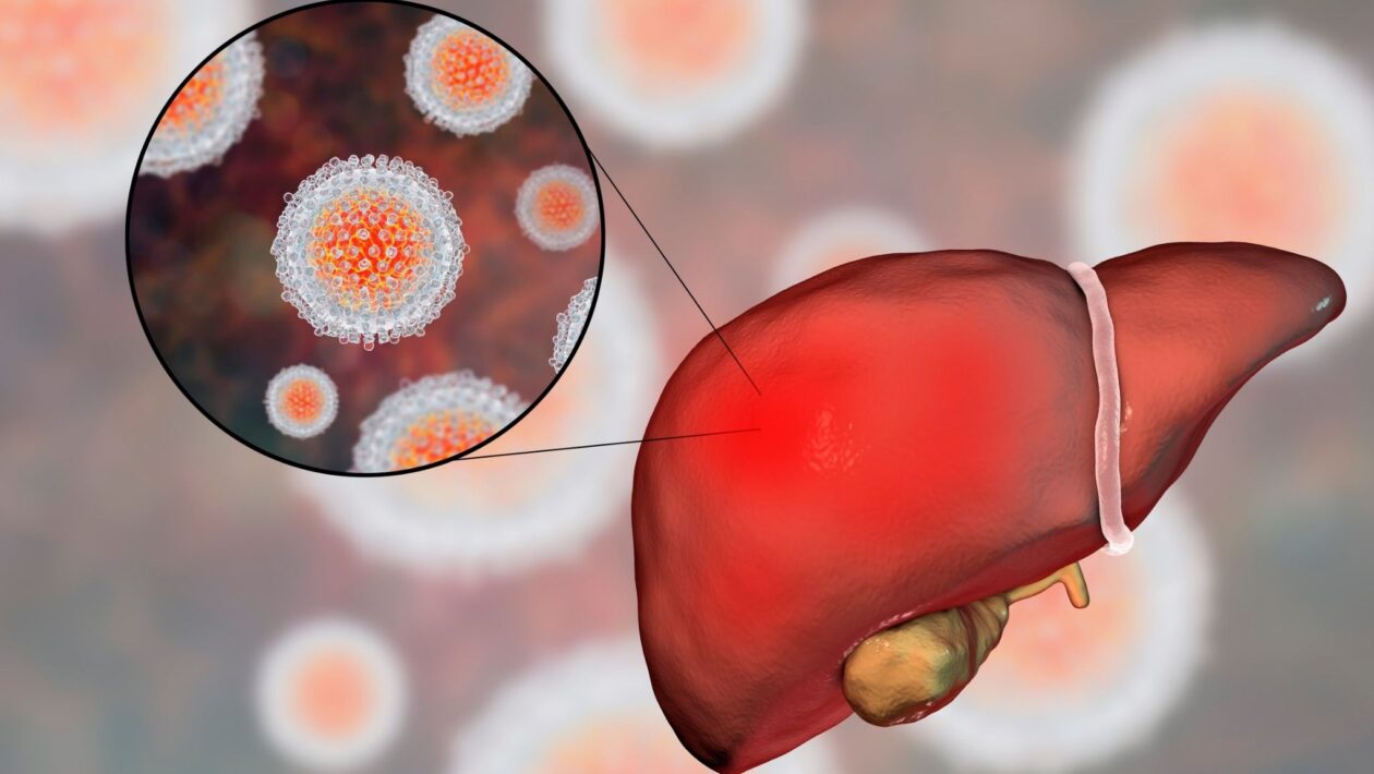 Alguns remédios comuns podem causar danos ao fígado. (Foto: Science Photo Library via Canva)