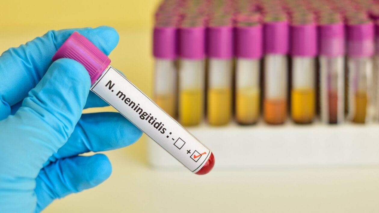 Caso de meningite confirmado em Alfredo Chaves acende alerta. (Foto: Getty Images via Canva)