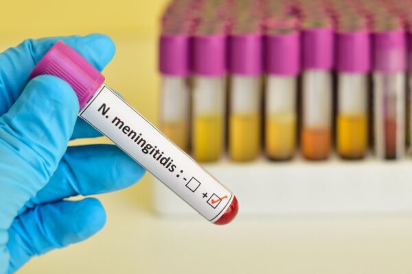 Caso de meningite confirmado em Alfredo Chaves acende alerta. (Foto: Getty Images via Canva)