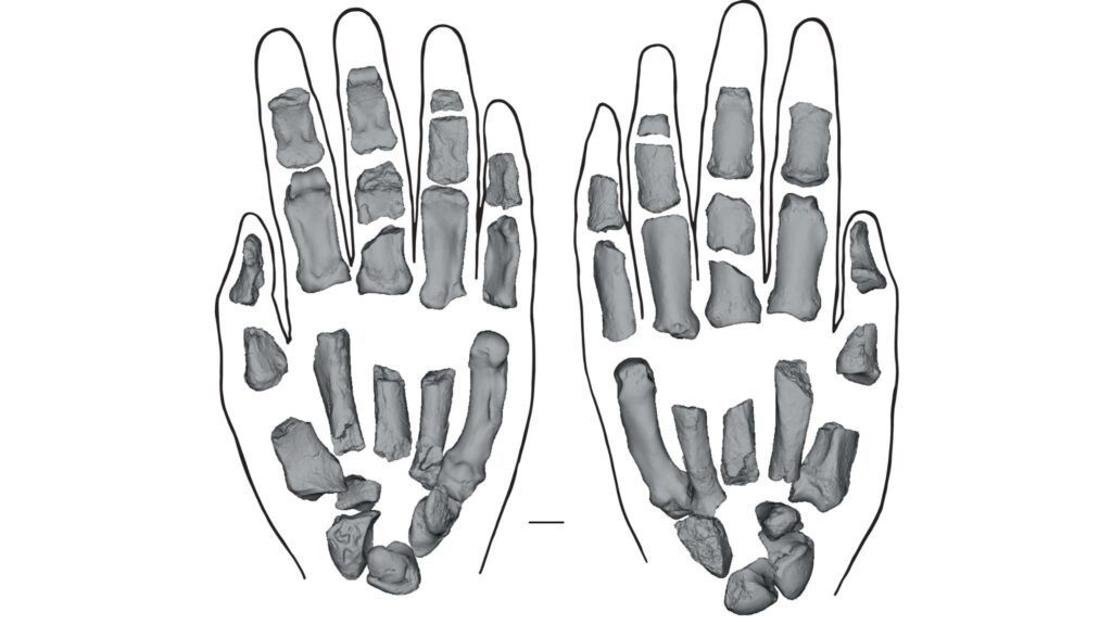 Mão fóssil revela precisão surpreendente no Paranthropus boisei. (Foto: Carrie S. Mongle et al / Nature)