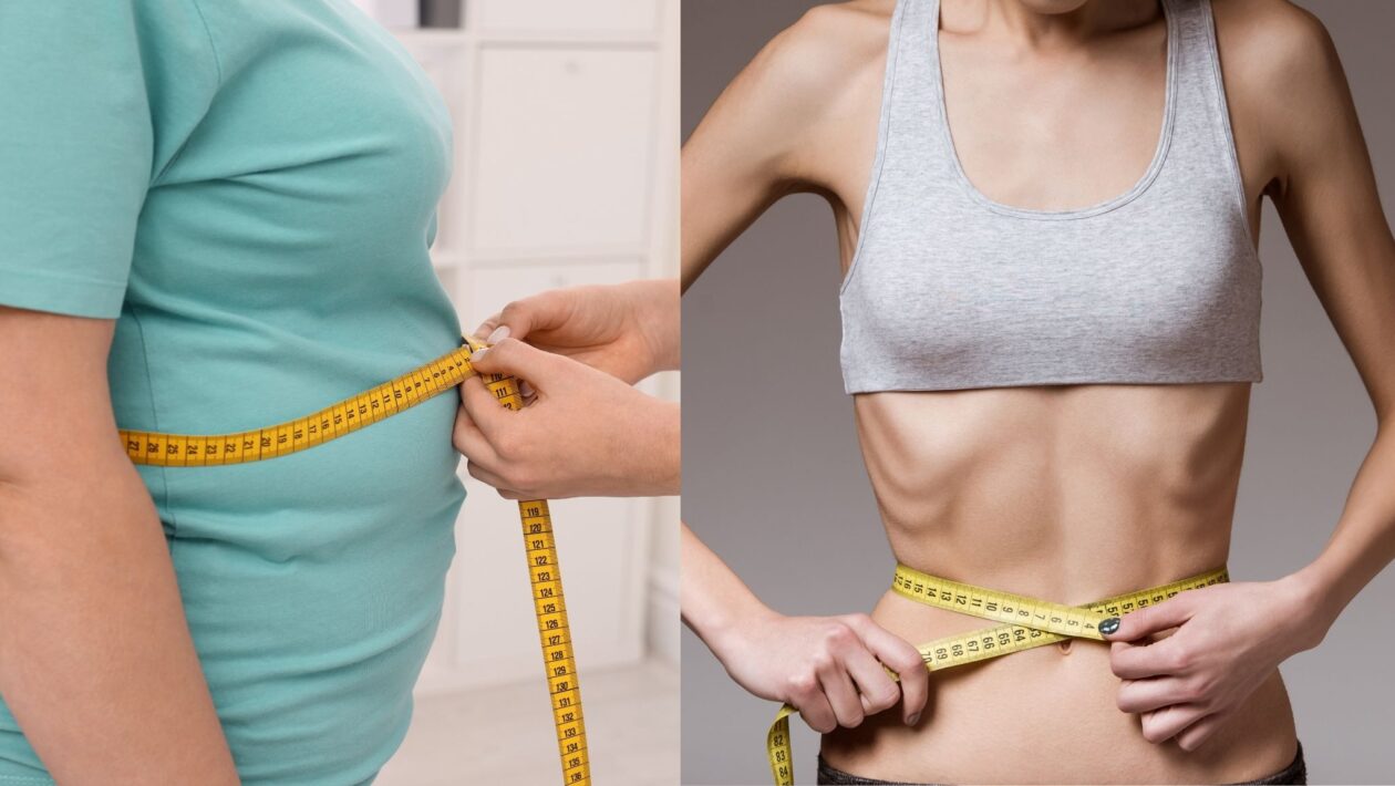 Obesidade e lipodistrofia compartilham riscos metabólicos. (Foto: Africa Images e Getty Images via Canva)