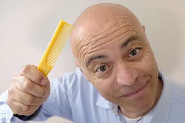 Álcool e açúcar em excesso enfraquecem os folículos capilares. (Foto: Getty Images via Canva)