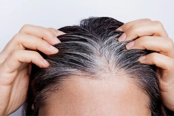 Estudo revela que fios brancos protegem contra o melanoma. (Foto: Getty Images via Canva)