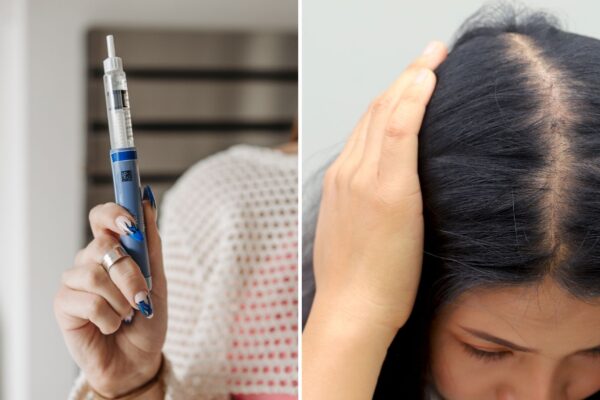 Perda de cabelo é efeito comum da perda rápida de peso. (Foto: Pexels e Rattanakun via Canva)