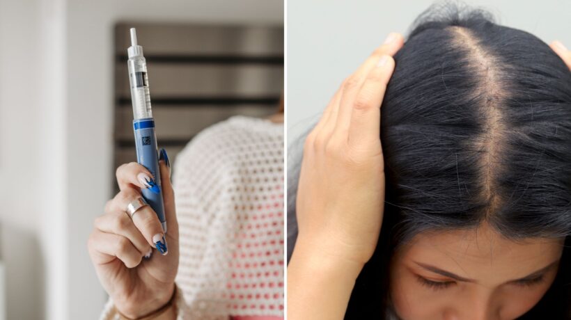 Perda de cabelo é efeito comum da perda rápida de peso. (Foto: Pexels e Rattanakun via Canva)