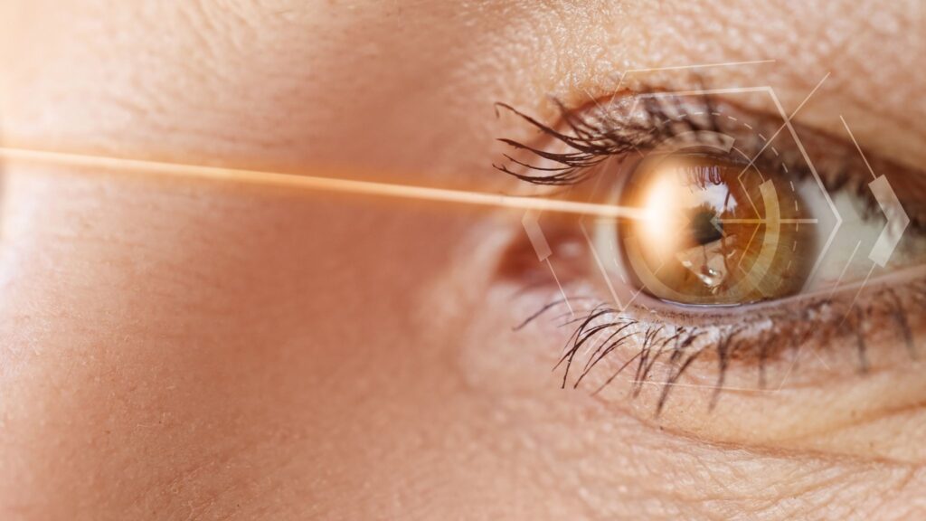 Miopia em alta impulsiona procura por cirurgia no Brasil. (Foto: Pixelshot via Canva)