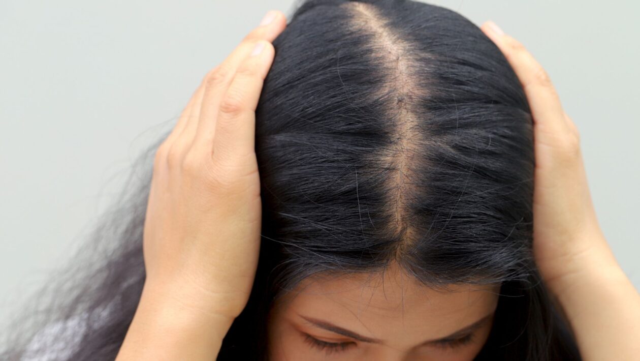 Queda de cabelo pode indicar deficiência de ferro ou vitamina D. (Foto: Rattanakun via Canva)