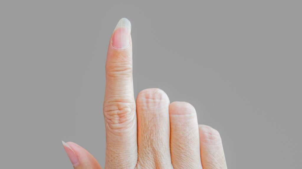 Unhas frágeis sinalizam baixa ingestão de nutrientes essenciais. (Foto: Getty Images via Canva)