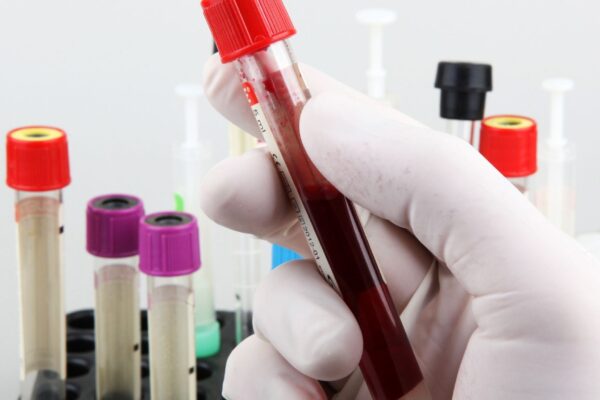 Estudo indica nova forma de detectar infarto silencioso. (Foto: Nenov brothers via Canva)