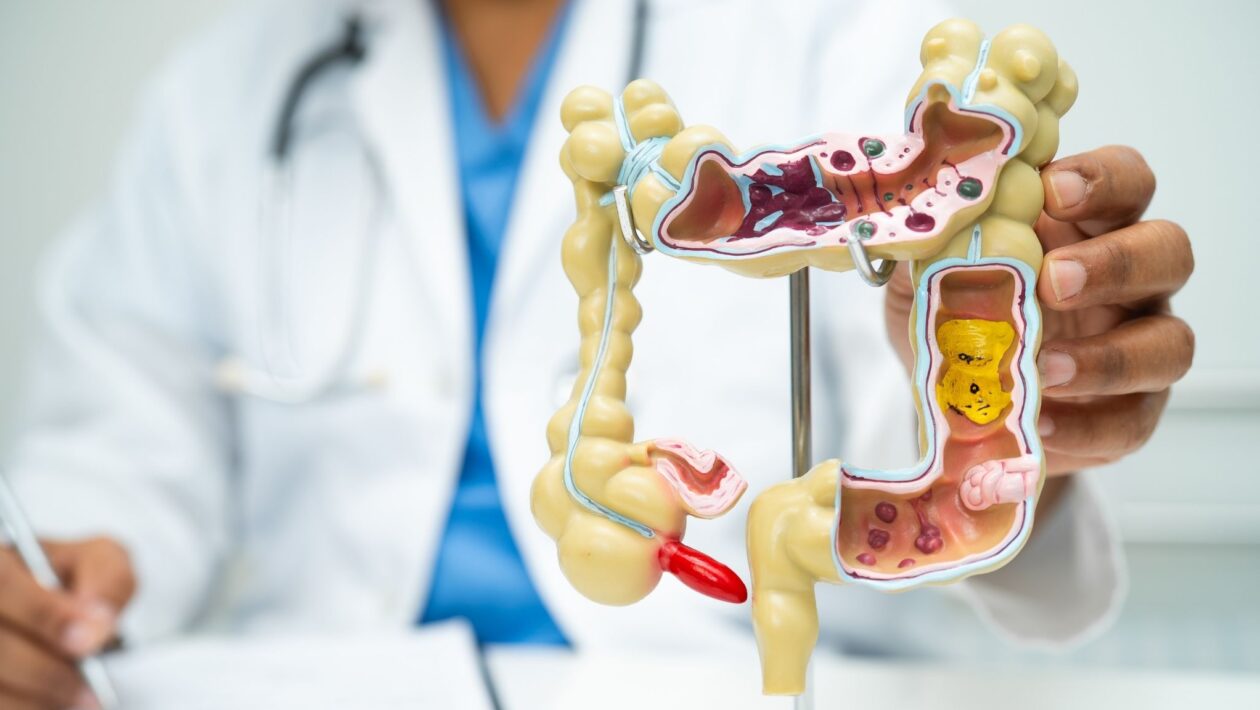 Intestino saudável ajuda a reduzir calorões na menopausa. (Foto: Pamai's Images via Canva)