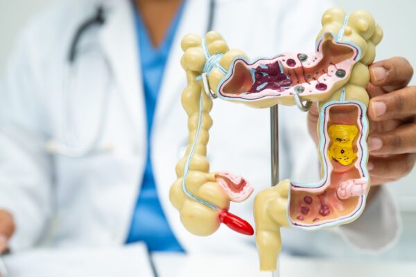 Intestino saudável ajuda a reduzir calorões na menopausa. (Foto: Pamai's Images via Canva)
