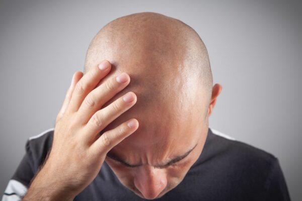 Microagulhas de estévia potencializam o efeito do minoxidil. (Foto: Getty Images via Canva)