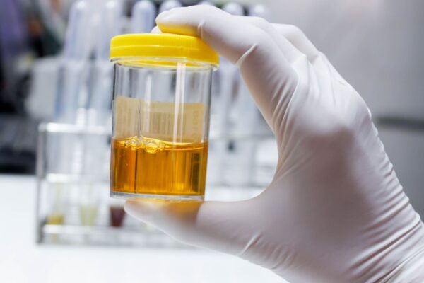 Tecnologia transforma ureia em proteína nutritiva. (Foto: Getty Images via Canva)