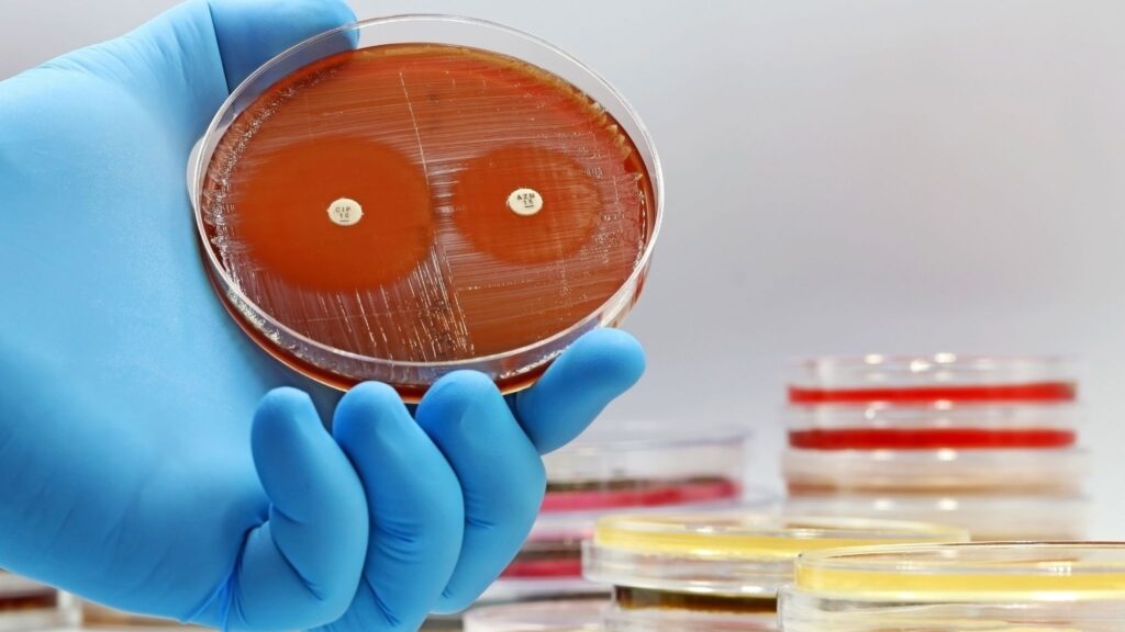 Novo alvo pode tornar antibióticos mais eficazes contra bactérias. (Foto: Getty Images via Canva)