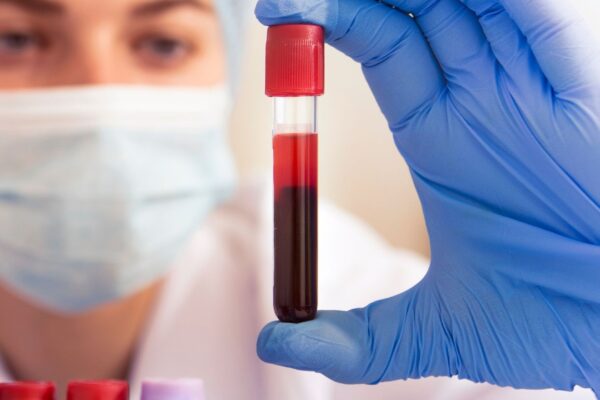 Inflamação silenciosa afeta diretamente a circulação sanguínea. (Foto: Getty Images via Canva)