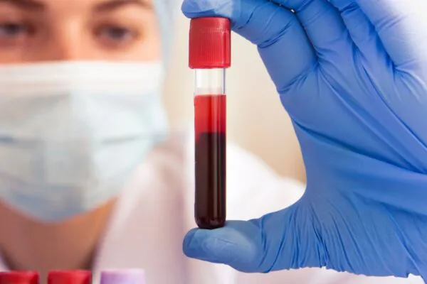 Inflamação silenciosa afeta diretamente a circulação sanguínea. (Foto: Getty Images via Canva)