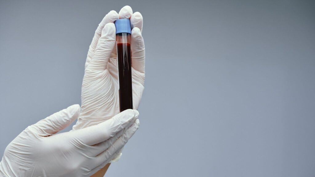 Privação de sono compromete a regeneração das células. (Foto: Rovsky via Canva)