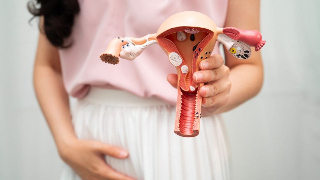 Mulheres pós-menopausa devem observar sinais de câncer uterino. (Foto: Pamai's Images via Canva)