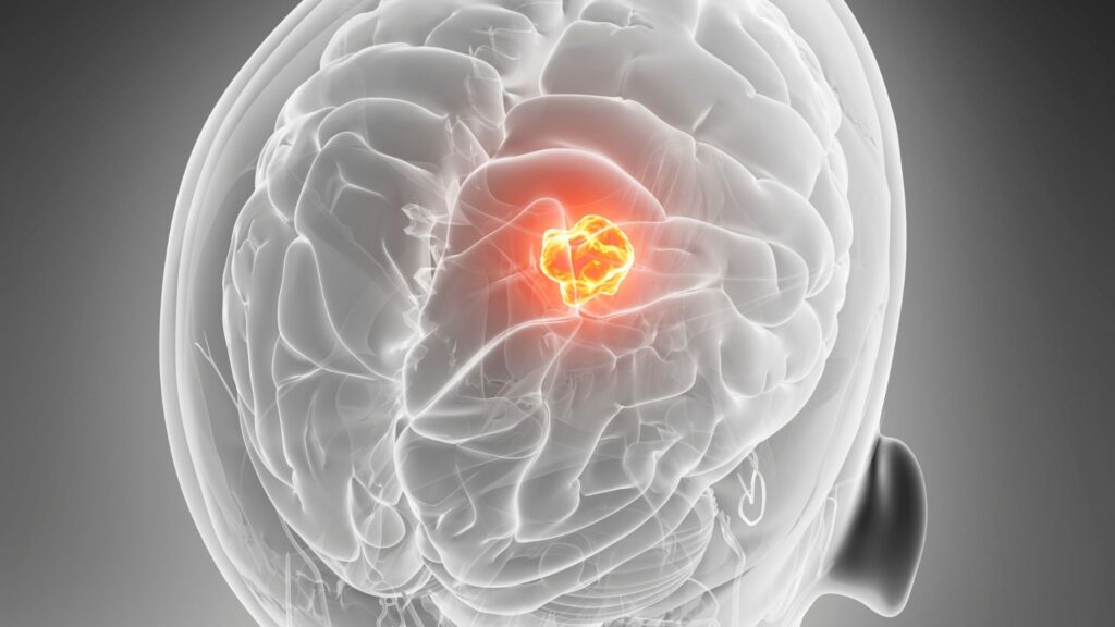 Transportador de nutrientes controla ritmo do tumor. (Foto: Photo Library via Canva)