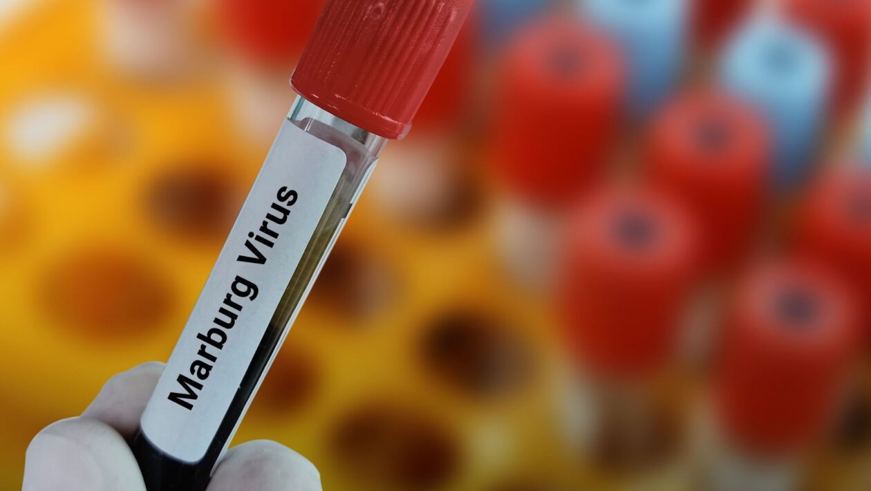 Surto do vírus de Marburg é confirmado na Etiópia. (Foto: Getty Images via Canva)