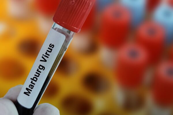 Surto do vírus de Marburg é confirmado na Etiópia. (Foto: Getty Images via Canva)