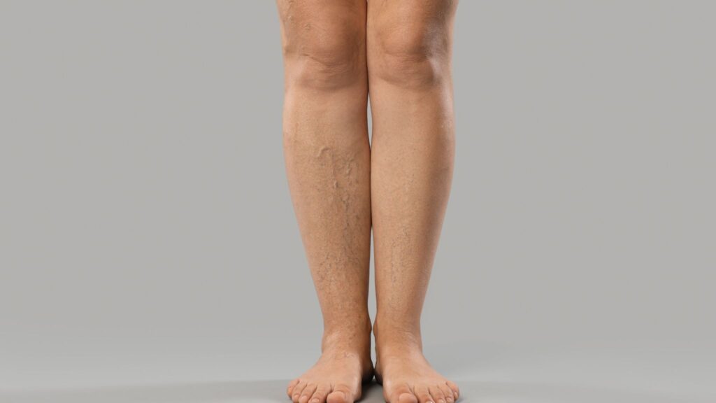 Pernas saudáveis dependem de nutrientes e circulação eficiente. (Foto: Africa Images via Canva)