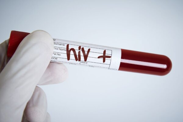 Brasil registra queda inédita nas mortes por Aids após 32 anos. (Foto: Getty Images via Canva)