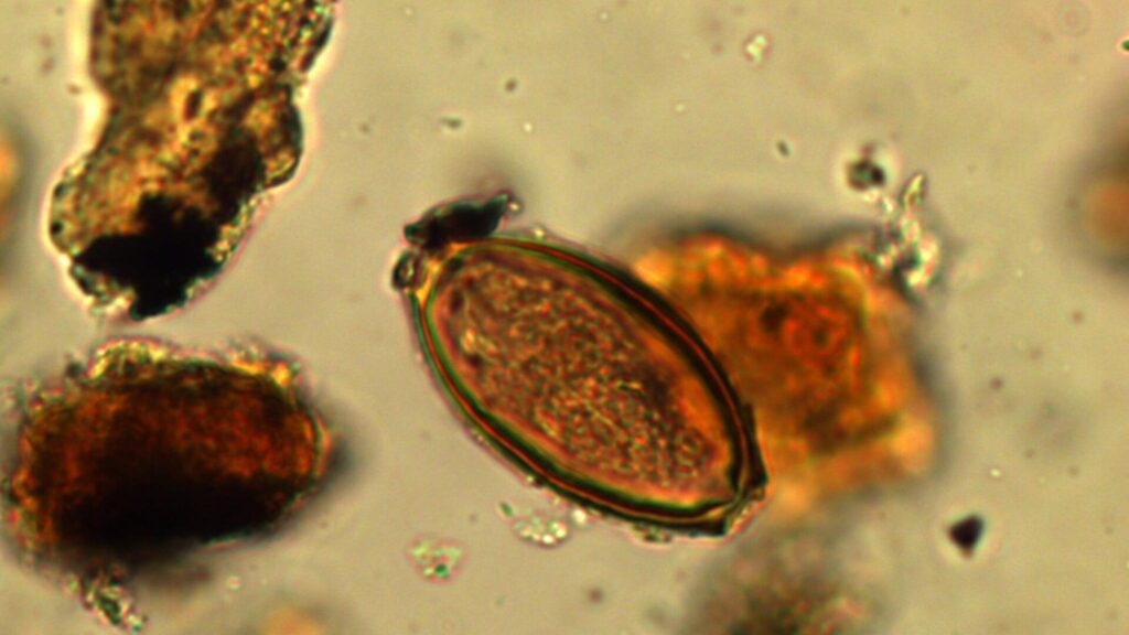 Giardia e vermes antigos afetavam a saúde militar romana. (Imagem: Marissa Ledger)
