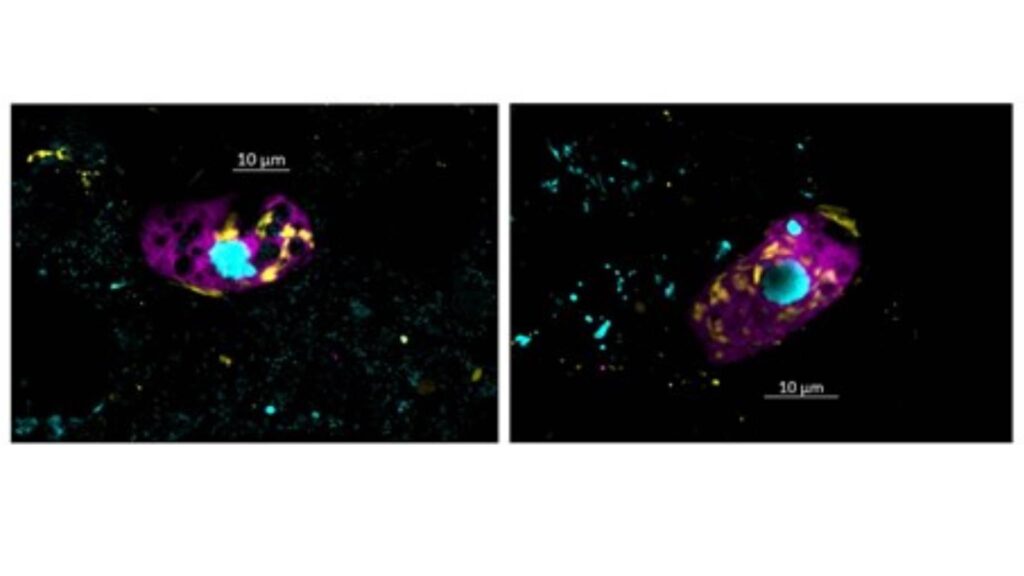 Microrganismos escondidos em esgotos podem gerar gases de efeito estufa (Imagem: Linus Matz Zeller, Instituto Max Planck de Microbiologia Marinha.)