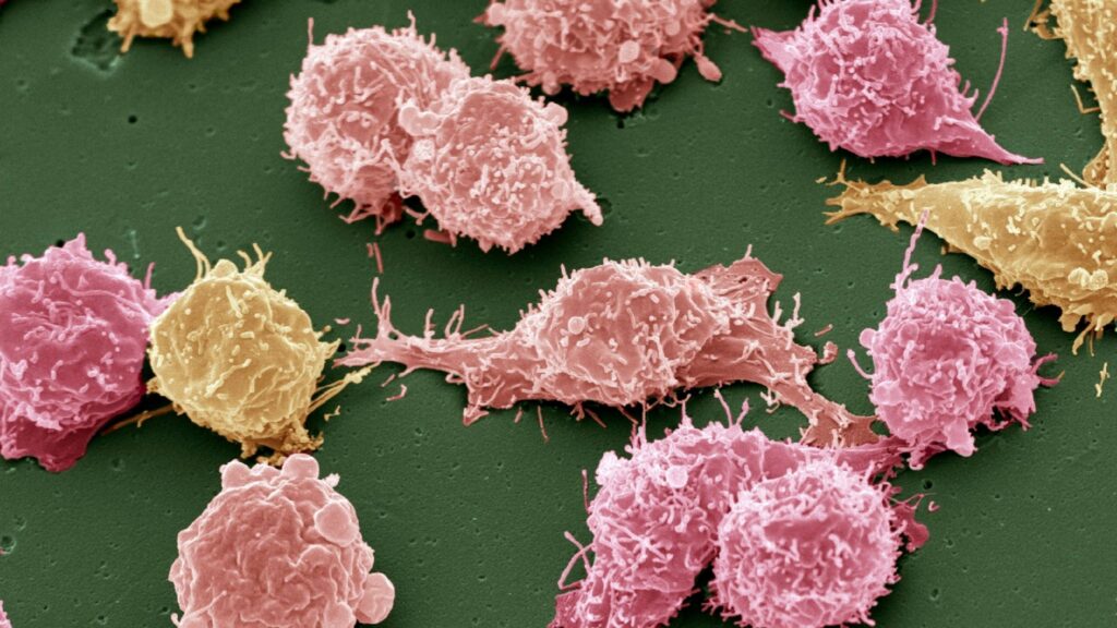 Imunoterapia pronta para uso mostra forte ação antitumoral. (Foto: Science Photo via Canva)