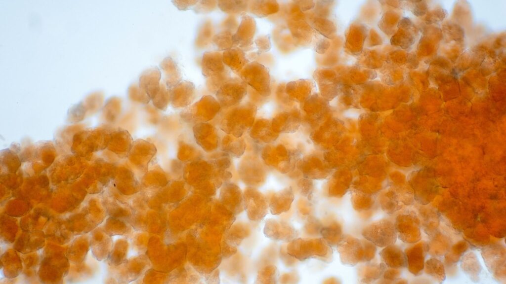 Adipócitos saudáveis dependem da proteína HSL no núcleo. (Foto: Getty Images via Canva)