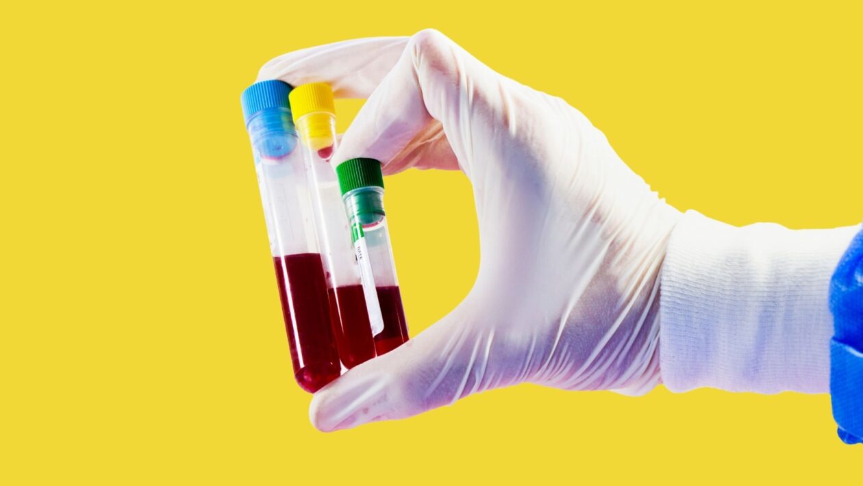 Novo marcador RAR ajuda a identificar risco de doença renal. (Foto: Getty Images via Canva)