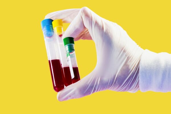 Novo marcador RAR ajuda a identificar risco de doença renal. (Foto: Getty Images via Canva)