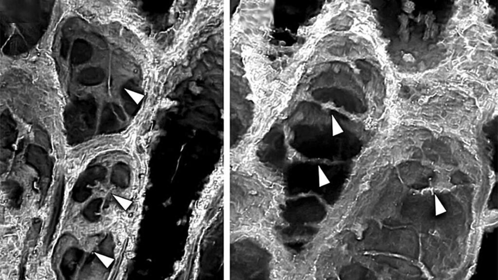 Fóssil de 400 milhões de anos mostra transporte de água e nutrientes. (Imagem: The Trustees of the Natural History Museum, London)
