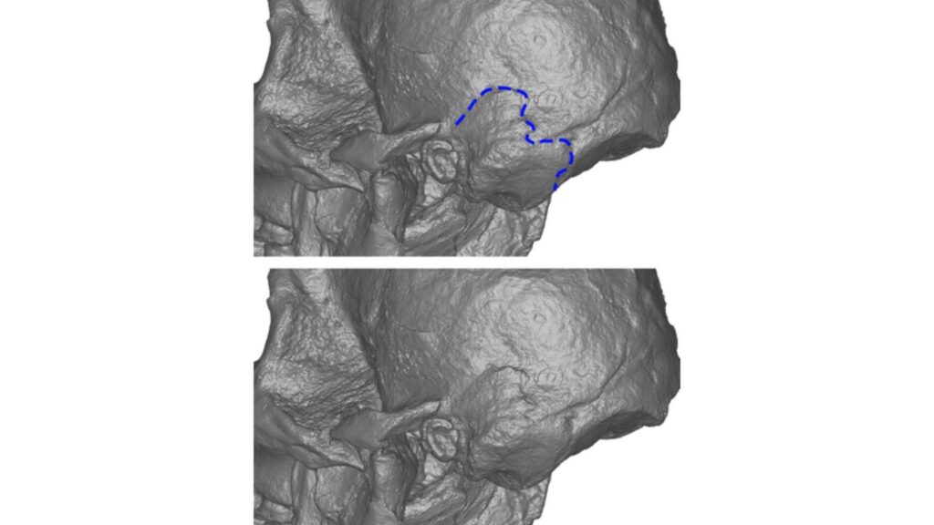 StW 573 lateral com entalhe asteriônico destacado em azul. (Foto: Jesse M. Martin via American Journal of Biological Anthropology)