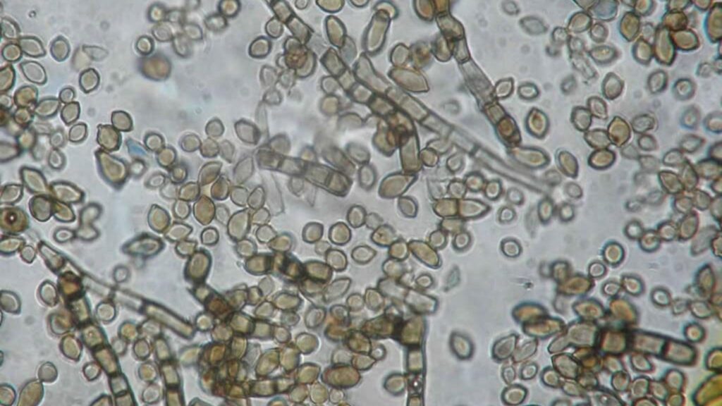 Microrganismo radioativo desafia lógica biológica e surpreende pesquisadores (Imagem: Rui Tomé/Atlas of Mycology)
