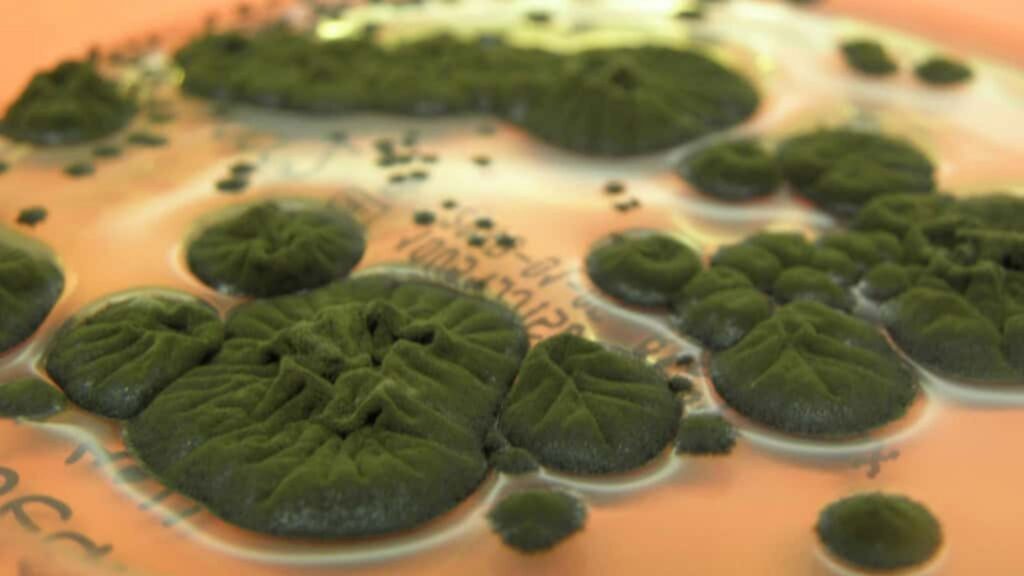 Melanina pode explicar a incrível resistência do fungo de Chernobyl (Imagem: Rui Tomé/Atlas of Mycology)
