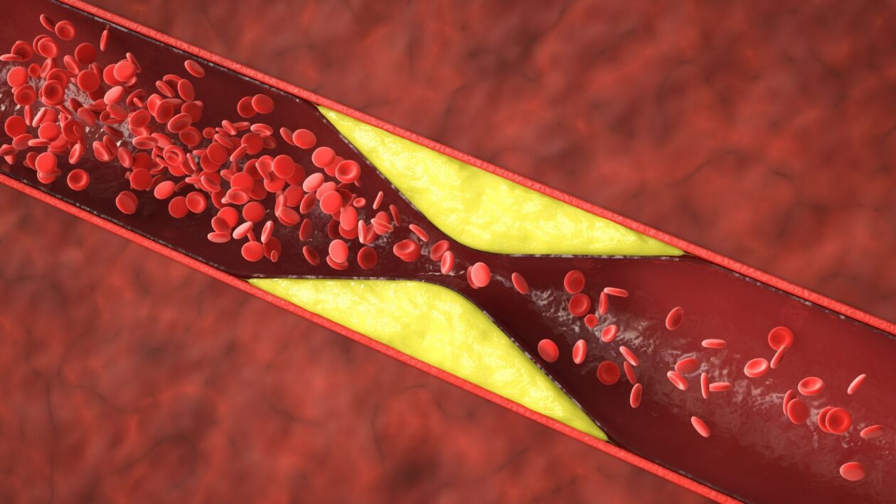 Fumo leve também inflama e endurece as artérias. (Foto: Phonlamai Photo's Images via Canva)