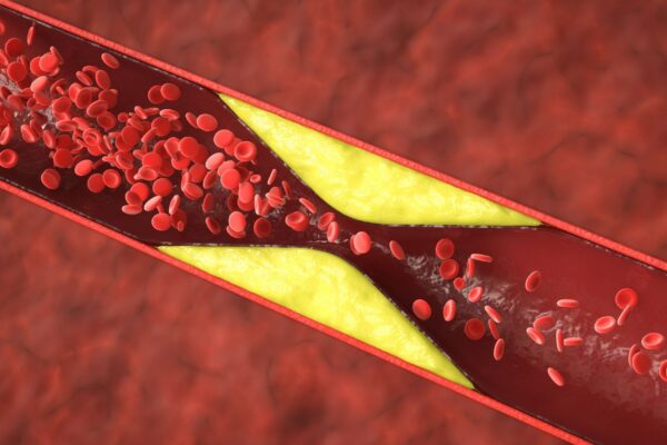 Fumo leve também inflama e endurece as artérias. (Foto: Phonlamai Photo's Images via Canva)